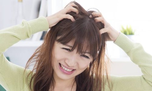 Asian woman scratching itchy head with frustrate face expression, female having hair problems.